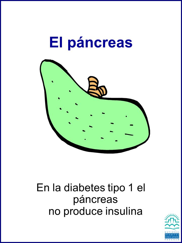 ¿Por qué no se produce insulina en la diabetes tipo 1?